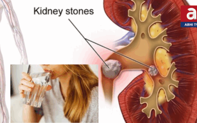 కిడ్నీలో రాళ్లు.. సమ్మర్ లోనే ఎక్కువ,, ఎందుకు ?