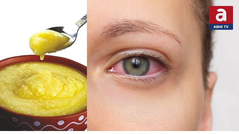 కళ్ళకు నెయ్యి స్నానం… ఇదేంటీ ?